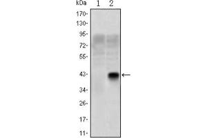 Western Blotting (WB) image for anti-Oligodendrocyte Lineage Transcription Factor 2 (OLIG2) antibody (ABIN1845900)