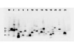 Twenty-four (24) clones were randomly selected and grown up from glycerol stocks by inoculating 0. (DYKDDDDK Tag anticorps)