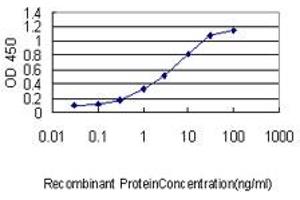 Detection limit for recombinant GST tagged SRF is approximately 0. (SRF anticorps  (AA 406-508))