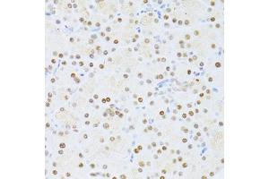 Immunohistochemistry of paraffin-embedded rat pancreas using ETV1 antibody (ABIN6291698) at dilution of 1:100 (40x lens). (ETV1 anticorps)