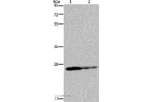 Western blot analysis of HT-29 cell and human fetal brain tissue, using GSTP1 Polyclonal Antibody at dilution of 1:350 (GSTP1 anticorps)