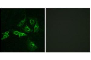 Immunofluorescence (IF) image for anti-Gonadotropin-Releasing Hormone Receptor (GNRHR) (Internal Region) antibody (ABIN1852968) (GNRHR anticorps  (Internal Region))