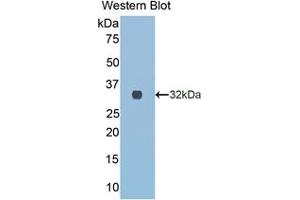 Western blot analysis of the recombinant protein. (COL3A1 anticorps  (AA 1171-1435))