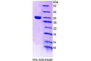 SDS-PAGE analysis of Human TEC Protein. (Tec Protein Tyrosine Kinase (TEC) Protéine)