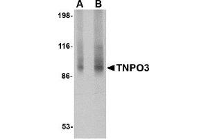 Western Blotting (WB) image for anti-Transportin 3 (TNPO3) (N-Term) antibody (ABIN1031695) (Transportin 3 anticorps  (N-Term))