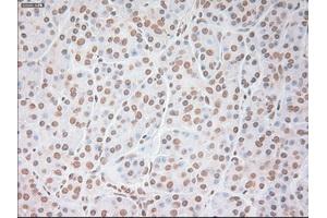Immunohistochemical staining of paraffin-embedded colon tissue using anti-VEGFmouse monoclonal antibody. (VEGF anticorps  (AA 27-233))
