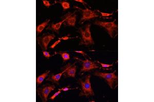 Immunofluorescence analysis of C6 cells using IR antibody (ABIN6130497, ABIN6142514, ABIN6142515 and ABIN6216327) at dilution of 1:100.