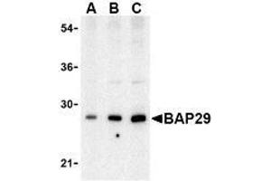 Western blot analysis of Bap29 in human heart tissue lysate with AP30120PU-N Bap29 antibody at (A) 0. (BCAP29 anticorps  (Intermediate Domain))