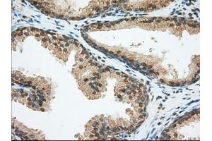Immunohistochemical staining of paraffin-embedded liver tissue using anti-BSG mouse monoclonal antibody. (CD147 anticorps)
