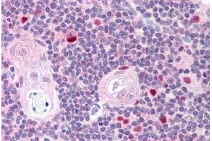 Human Thymus (formalin-fixed, paraffin-embedded) stained with AIRE antibody ABIN293603 at 2. (AIRE anticorps  (AA 102-115))