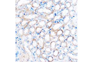Immunohistochemistry of paraffin-embedded Mouse kidney using PDXP Rabbit pAb (ABIN7269758) at dilution of 1:100 (40x lens). (PDXP anticorps  (C-Term))