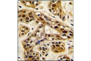 Image no. 1 for anti-Protein Arginine Methyltransferase 1 (PRMT1) (C-Term) antibody (ABIN356520) (PRMT1 anticorps  (C-Term))