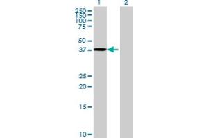 Western Blot analysis of TTLL1 expression in transfected 293T cell line by TTLL1 MaxPab polyclonal antibody. (TTLL1 anticorps  (AA 1-423))