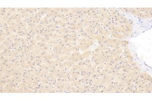 Detection of a2PI in Human Liver Tissue using Polyclonal Antibody to Alpha 2-Antiplasmin (a2PI) (a2PI anticorps)