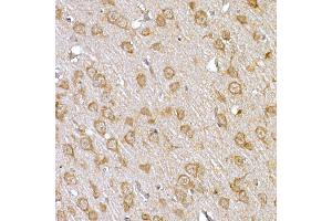 Immunohistochemistry of paraffin-embedded rat brain using IRS1 Rabbit pAb (ABIN3020773, ABIN3020774, ABIN3020775, ABIN1513104 and ABIN6213716) at dilution of 1:150 (40x lens). (IRS1 anticorps)