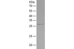Western Blotting (WB) image for Tropomyosin 1 (Alpha) (TPM1) (AA 1-284) protein (His tag) (ABIN7125504)