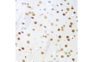 Immunohistochemistry of paraffin-embedded mouse brain using UNG antibody. (UNG anticorps)