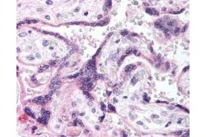 Immunohistochemistry of Rabbit anti-EGFR pY1197 antibody.