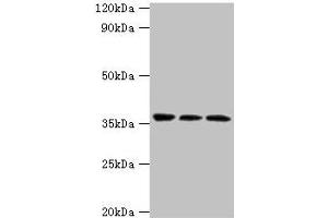 Western blot All lanes: SLAMF7 antibody at 3 μg/mL Lane 1: Jurkat whole cell lysate Lane 2: K562 whole cell lysate Lane 3: Mouse spleen tissue Secondary Goat polyclonal to rabbit IgG at 1/10000 dilution Predicted band size: 38, 26, 18, 33, 23, 22 kDa Observed band size: 38 kDa (SLAMF7 anticorps  (AA 23-226))