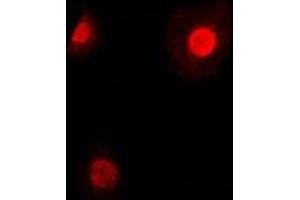 Immunofluorescent analysis of TEAD2 staining in HepG2 cells. (TEAD2 anticorps)