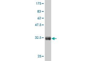 Western Blot detection against Immunogen (36. (CTNNB1 anticorps  (AA 682-781))