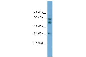 WB Suggested Anti-WDR16 Antibody Titration: 0. (WDR16 anticorps  (Middle Region))