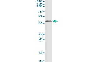 Immunoprecipitation of SORD transfected lysate using anti-SORD monoclonal antibody and Protein A Magnetic Bead , and immunoblotted with SORD MaxPab rabbit polyclonal antibody.