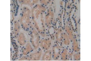 IHC-P analysis of Human Kidney Tissue, with DAB staining. (PLAT anticorps  (AA 311-562))