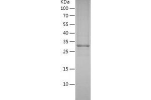 Western Blotting (WB) image for Cytochrome P450, Family 3, Subfamily A, Polypeptide 4 (CYP3A4) (AA 244-503) protein (His tag) (ABIN7122583)