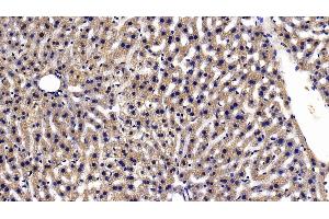 Detection of TXNRD1 in Mouse Liver Tissue using Polyclonal Antibody to Thioredoxin Reductase 1 (TXNRD1) (TXNRD1 anticorps  (AA 374-577))
