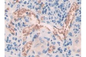 Detection of BND3 in Human Kidney Tissue using Polyclonal Antibody to Band 3 (BND3)