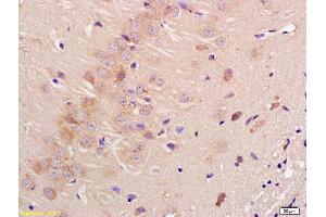 Formalin-fixed and paraffin embedded rat brain labeled with Anti-Contactin 3 Polyclonal Antibody, Unconjugated (ABIN761441) at 1:200 followed by conjugation to the secondary antibody and DAB staining (CNTN3 anticorps  (AA 301-400))