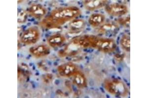 Used in DAB staining on fromalin fixed paraffin-embedded Kidney tissue (PDGF-AA Homodimer (AA 87-211) anticorps)