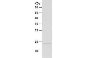 Western Blotting (WB) image for Melan A (MLANA) (AA 48-118) protein (His tag) (ABIN7123880)
