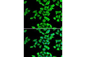 Immunofluorescence analysis of U2OS cells using NMT2 antibody (ABIN5974237).