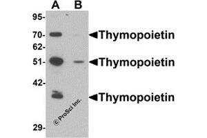 Western Blotting (WB) image for anti-Thymopoietin (TMPO) (N-Term) antibody (ABIN1031615) (Thymopoietin anticorps  (N-Term))