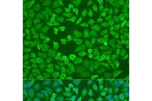 Immunofluorescence analysis of U2OS cells using EIF3A Polyclonal Antibody at dilution of 1:100. (EIF3A anticorps)
