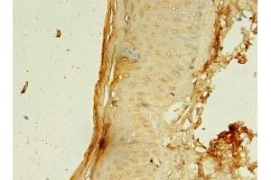 Immunohistochemistry of paraffin-embedded human skin tissue using ABIN7148112 at dilution of 1:100 (CCDC24 anticorps  (AA 1-307))