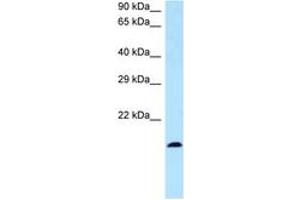 Image no. 1 for anti-Bone Marrow Stromal Cell Antigen 2 (BST2) (N-Term) antibody (ABIN6747353) (BST2 anticorps  (N-Term))