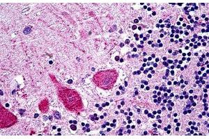 Human Brain Cerebellum: Formalin-Fixed, Paraffin-Embedded (FFPE) (TRIM71 anticorps  (AA 390-402))