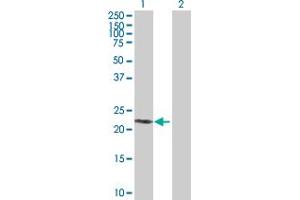 Western Blot analysis of SIRPD expression in transfected 293T cell line by SIRPD MaxPab polyclonal antibody. (SIRPD anticorps  (AA 1-197))