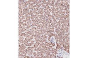 Immunohistochemical analysis of A on paraffin-embedded Human liver tissue. (Prohibitin anticorps  (N-Term))