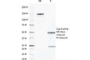 SDS-PAGE Analysis Purified CD40 Mouse Monoclonal Antibody (C40/2383). (CD40 anticorps  (AA 29-107))