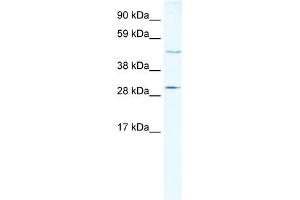 WB Suggested Anti-CASP3 Antibody Titration:  5ug/ml  Positive Control:  Human Liver (Caspase 3 anticorps  (N-Term))