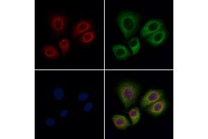 ABIN6262848 and ABIN6276891 staining Hela cells by IF/ICC. (Kallikrein 1 anticorps  (Internal Region))