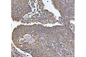 IHC analysis of COX5B using anti-COX5B antibody (ABIN7598975).