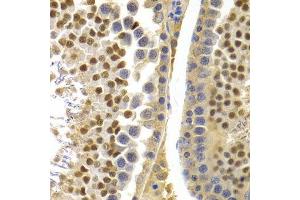 Immunohistochemistry (IHC) image for anti-Apolipoprotein B mRNA Editing Enzyme, Catalytic Polypeptide-Like 3G (APOBEC3G) (AA 60-330) antibody (ABIN3021984)