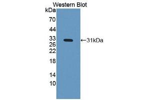 Western blot analysis of the recombinant protein. (IGFBP4 anticorps  (AA 22-258))