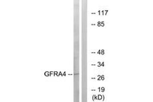 Western blot analysis of extracts from HeLa cells, using GFRA4 Antibody. (GFRA4 anticorps  (AA 141-190))