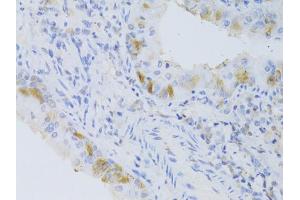 Immunohistochemistry of paraffin-embedded mouse lung using CYP2C9 Antibody (ABIN5973660) at dilution of 1/100 (40x lens). (CYP2C9 anticorps)